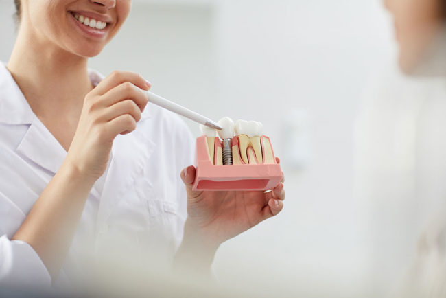 Implantes Dentales Envigado Medellín