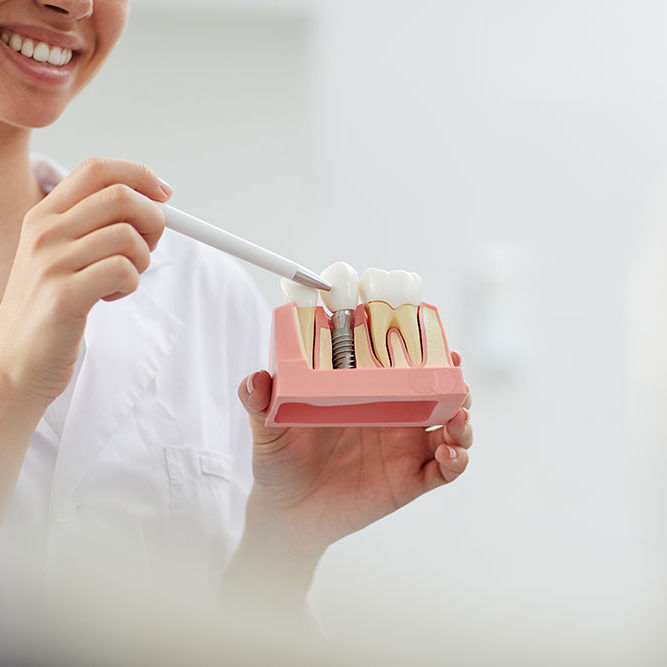 Implantes Dentales Envigado Medellín