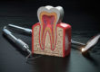 Periodoncia Envigado Medellín