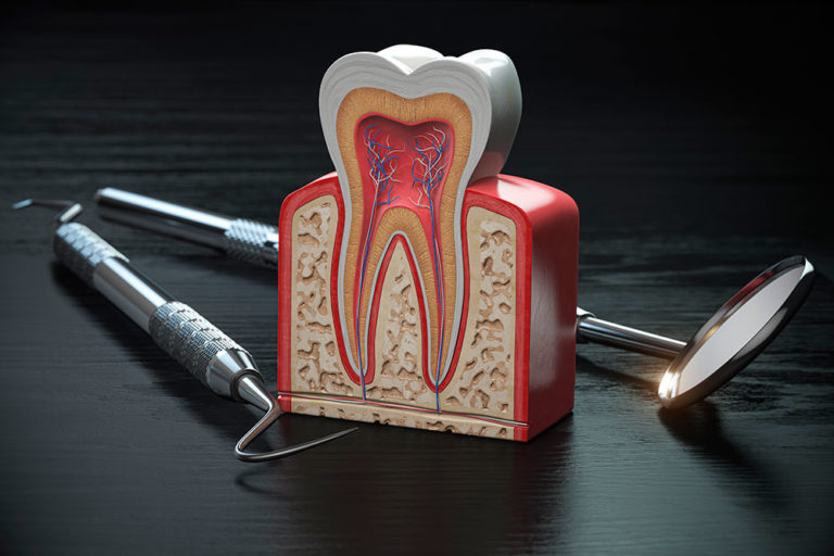 Periodoncia Envigado Medellín
