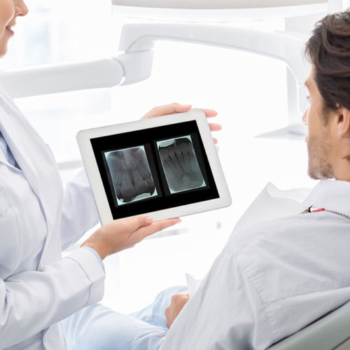 radiografias dentales | periapicales | Envigado Medellín