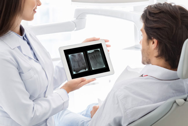 radiografias dentales | periapicales | Envigado Medellín