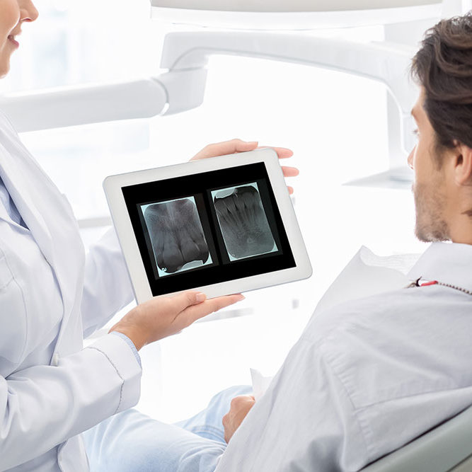 radiografias dentales | periapicales | Envigado Medellín