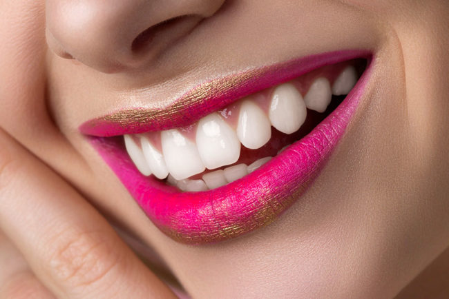 Recorte de encía Gingivectomia