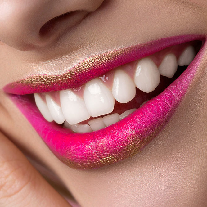 Recorte de encía Gingivectomia
